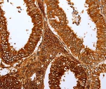 FOXN1 Antibody - SAB | Signalway Antibody