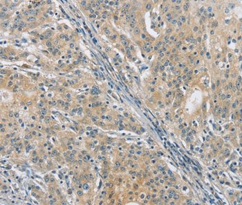 PKD1 Antibody