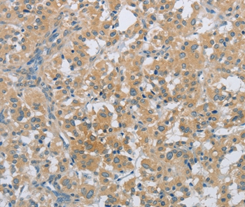 PKD1 Antibody