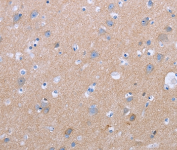 CXCR3  Antibody