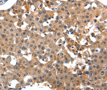 GRM1 Antibody