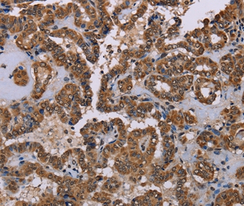 GRK1 Antibody