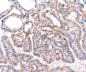 ADRBK1  Antibody