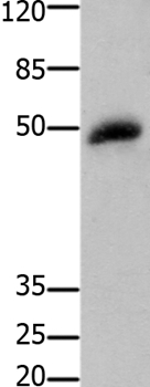 GSK3B Antibody