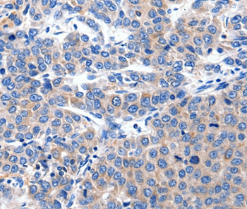 KCNH8 Antibody