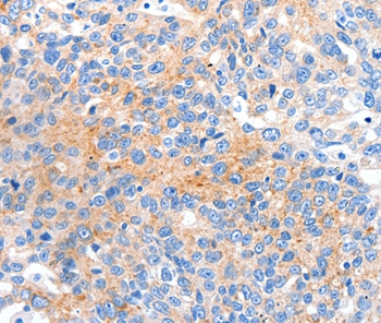 HCN2 Antibody