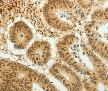 HOXA4 Antibody