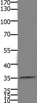 HOXD11 Antibody