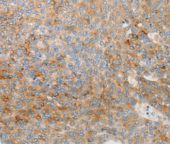 IGFBP1 Antibody