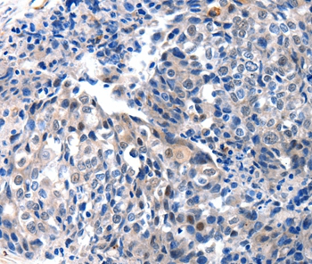 IGFBP7 Antibody