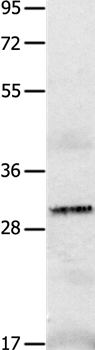 IL2RA Antibody