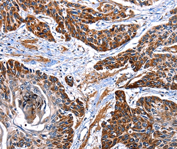 ITGA7 Antibody