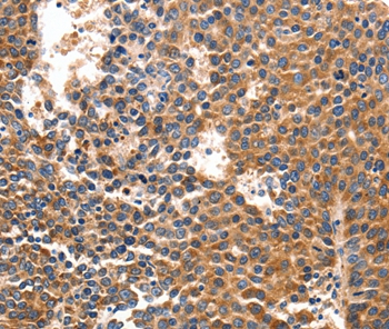 IRF1 Antibody