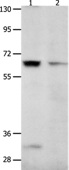 KCNC2 Antibody