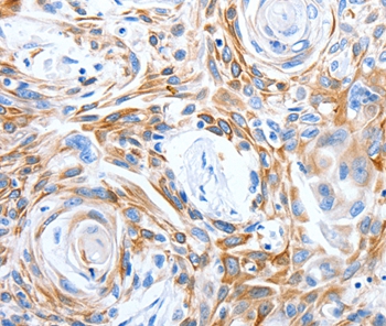 LRIG3 Antibody