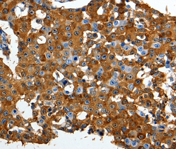 LRP1  Antibody