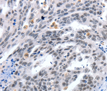 LRP5 Antibody