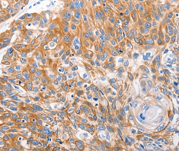 LRP2 Antibody