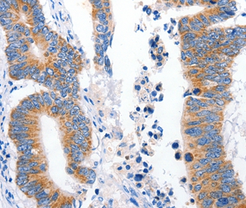 LRP2 Antibody