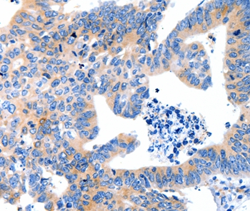 LRPAP1 Antibody