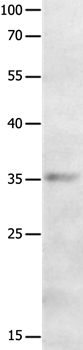 MAGEA2 Antibody