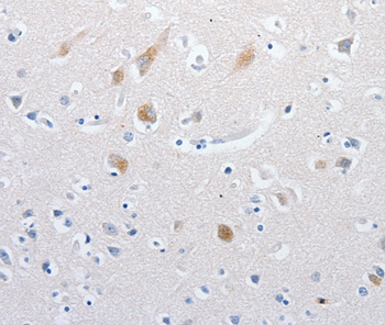 MATN1 Antibody