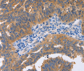 NBEA Antibody