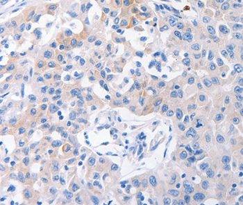 SLC10A1 Antibody