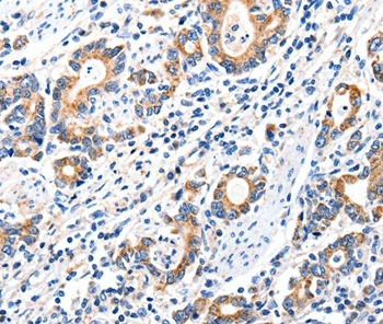 GRIA2 Antibody