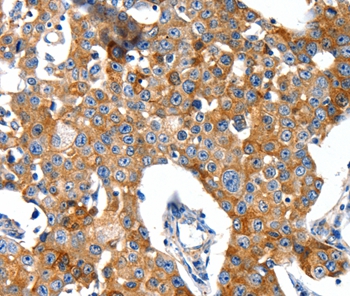 GRIA2 Antibody