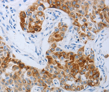 P2RY4 Antibody