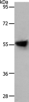 SLC1A4 Antibody