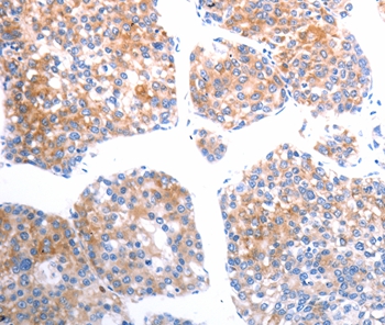 SLC44A1 Antibody