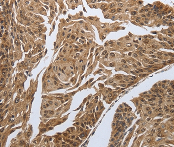 MYH11 Antibody