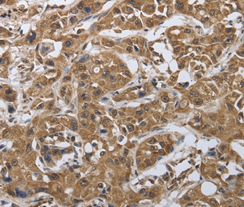 MYH11 Antibody