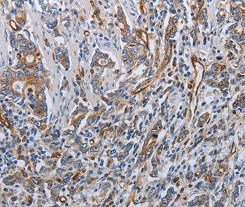 SOCS1 Antibody