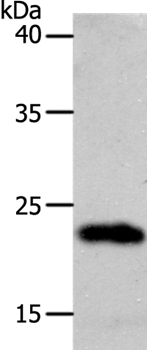 SOCS1 Antibody