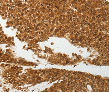 SOCS7 Antibody