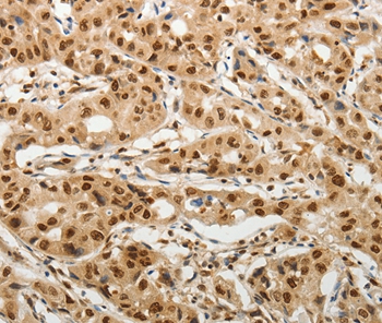 SOCS7 Antibody