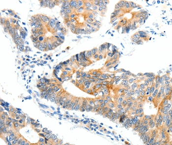 NTRK1 Antibody