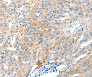 NTRK1 Antibody