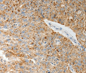 COL4A3 Antibody