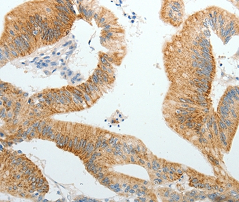 PGBD5  Antibody