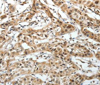 FZD3 Antibody