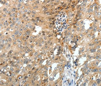 FZD3 Antibody