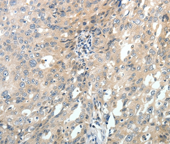 ABCC10 Antibody