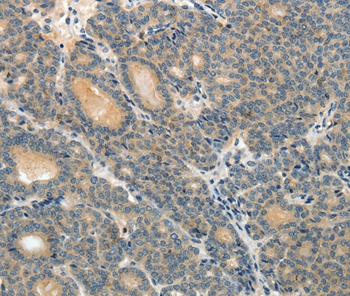 ABCC12 Antibody