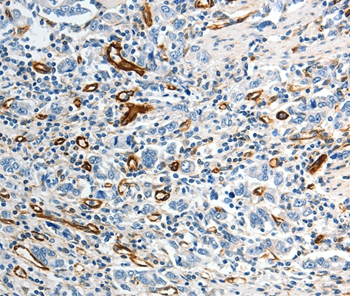 ABCG1 Antibody