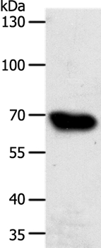 ABCG1 Antibody