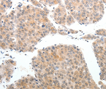 ABL2 Antibody